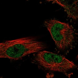 NKX6.1 Antibody, Novus Biologicals:Antibodies:Primary Antibodies